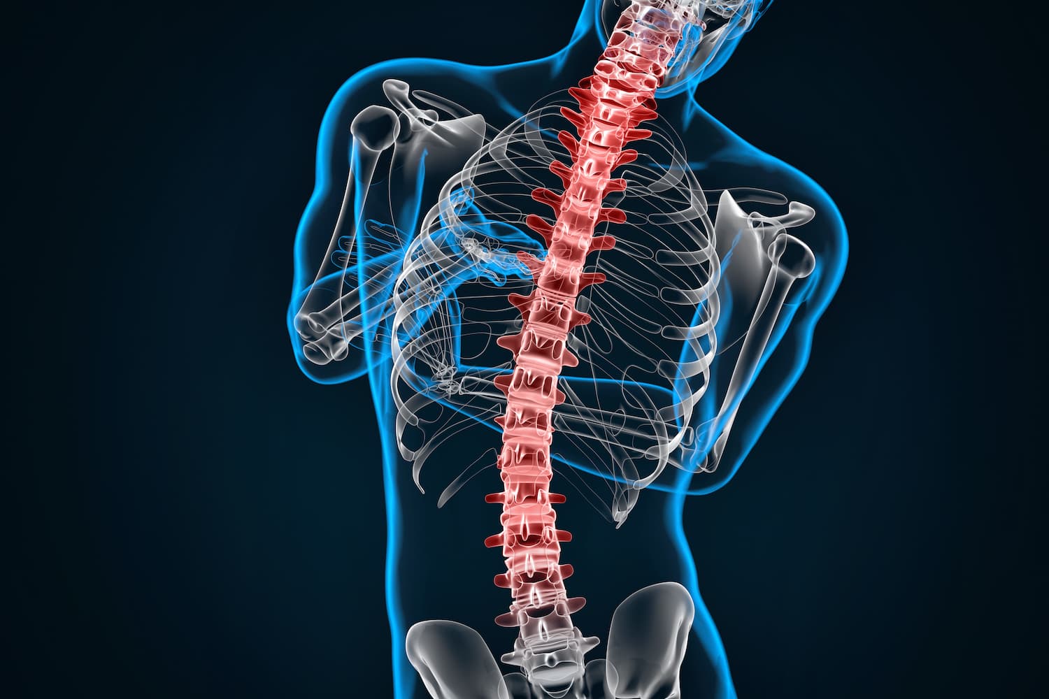 https://www.circle8massage.co.uk/wp-content/uploads/2022/02/scoliosis-explained.jpg