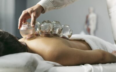 What are the Benefits of Cupping?